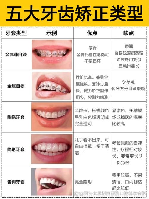成人畸牙如何矫正_成人矫正牙齿的危害_成人矫正牙畸形多少钱
