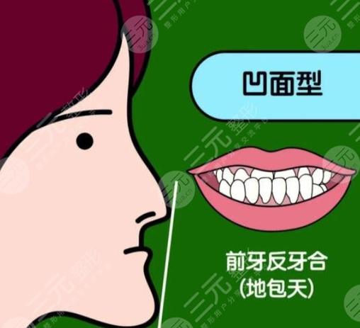 小孩地包天矫正医保报销吗_儿童矫正地包天价格_深圳儿童地包天矫正多少钱