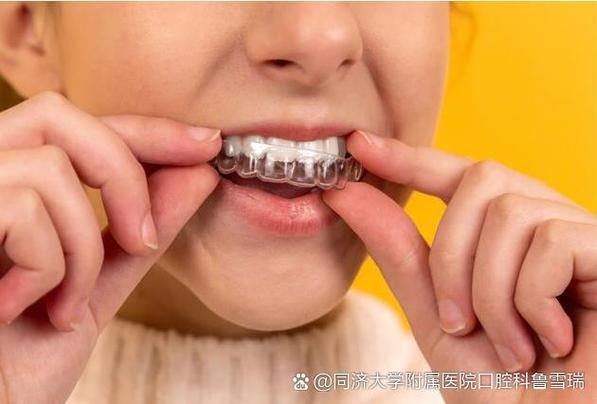6岁孩子牙齿矫正最佳年龄_牙齿矫正最好在几岁_牙齿矫正年龄最佳孩子是多少岁