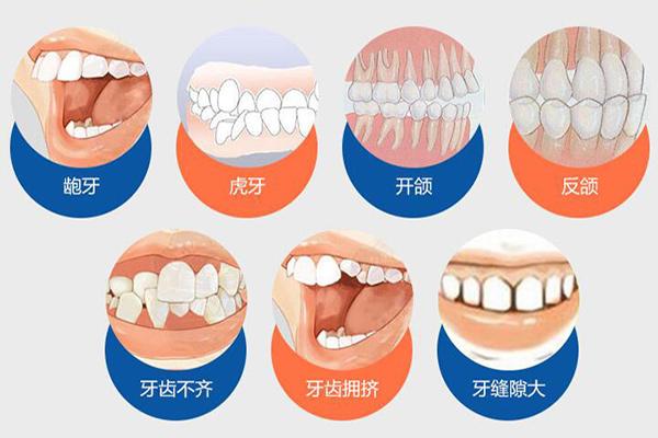 合肥隐形牙齿矫正费用贵不贵?要多少钱?