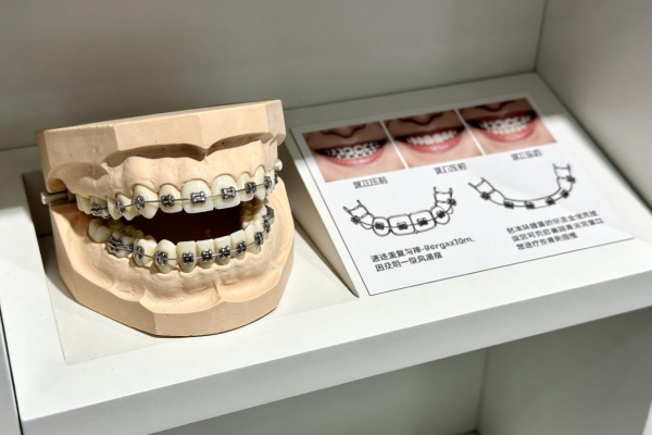 2026矫正牙齿价格表｜从8k到8w，不同方式费用明细全解析