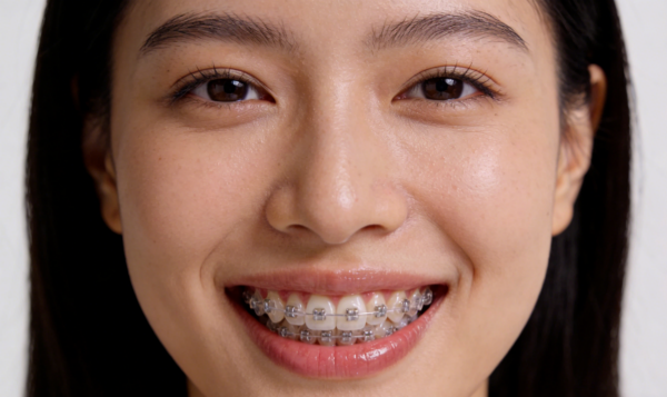 牙齿矫正多大年龄合适？全年龄段科学指南（2026版）