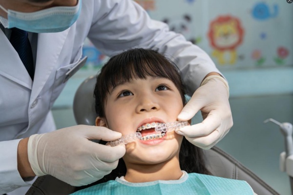 儿童牙齿矫正多少钱？2026年最新报价+家长必看避坑指南