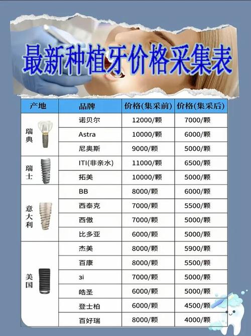 德韩口腔种直牙好吗_德韩口腔医院种牙多少钱_德韩口腔种植牙