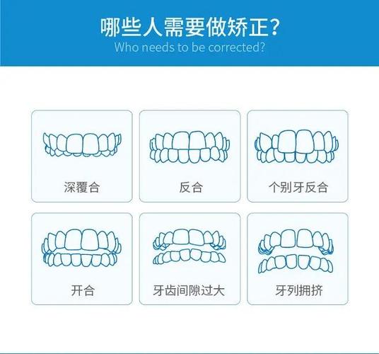 龙华大浪小孩矫正多少钱_龙华大浪小孩矫正多少钱_龙华大浪小孩矫正多少钱
