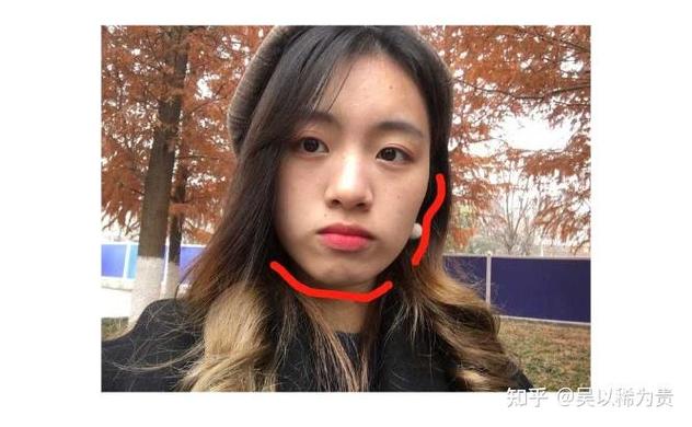 龙华大浪小孩矫正多少钱_龙华大浪小孩矫正多少钱_龙华大浪小孩矫正多少钱