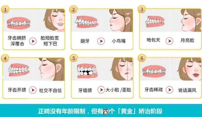 深圳市牙齿矫正哪个医生比较好_深圳青少年牙齿拥挤矫正医院_深圳医院牙齿矫正多少钱