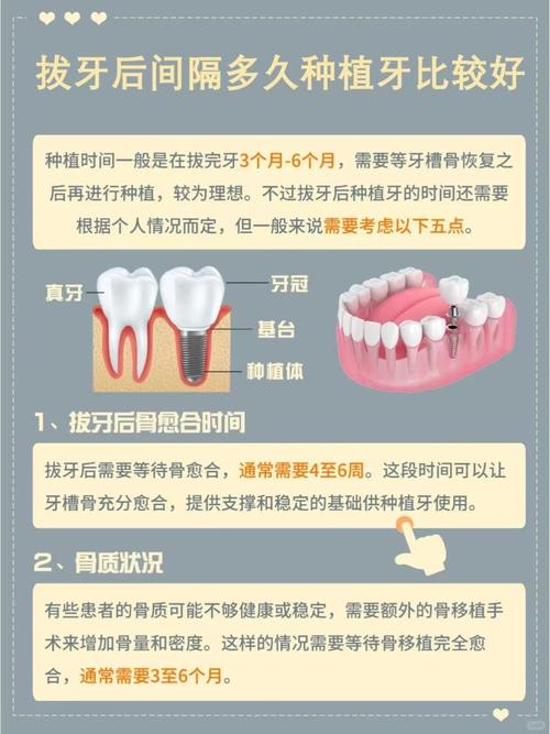 拔牙即可种植_拔牙一个月能种植牙_种植牙可以拔了就种吗