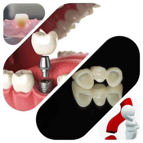 没有种牙的条件怎么办_没有牙齿除了种牙还有什么办法_怎样种牙没事