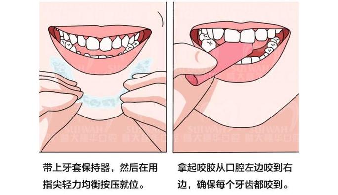 牙齿矫正价格_怎么矫正牙齿_牙齿矫正的十大危害
