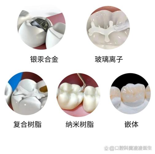 补种植牙对身体好吗_补牙齿哪种牙齿好_牙齿补种有几种