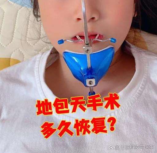 正颌手术矫正牙齿靠谱吗,效果能维持多久