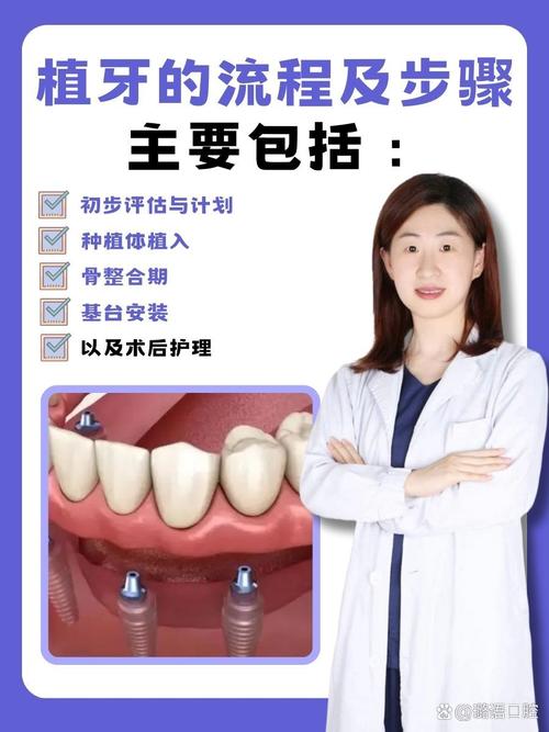 登特口腔植牙怎么样 缺牙必看攻略