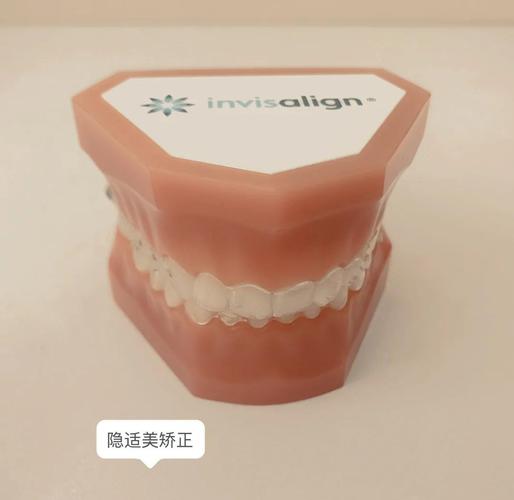 矫正牙齿缝隙多少钱_深圳牙缝过大矫正报价_矫正牙缝过大的费用是多少