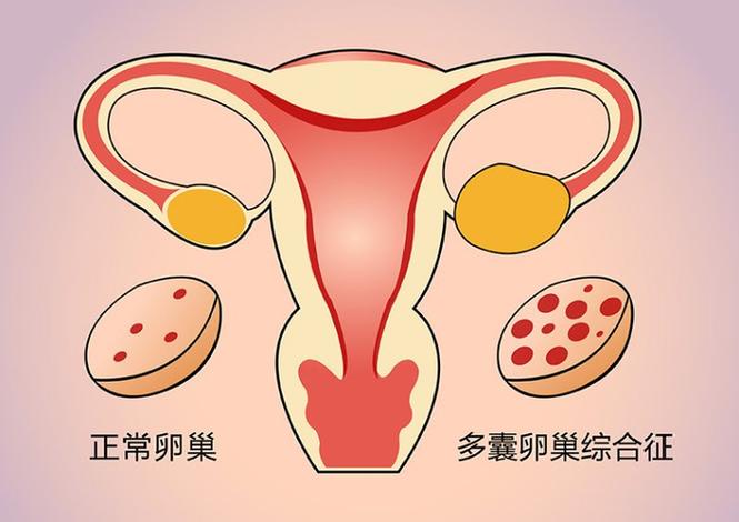 试管基因筛查主要筛查什么项目_三代试管基因筛查准确吗_试管基因筛查不孕
