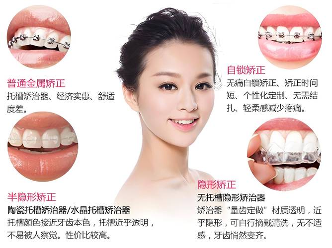 成人牙齿矫正_成人矫正牙齿有年龄限制吗_成年人 牙齿矫正