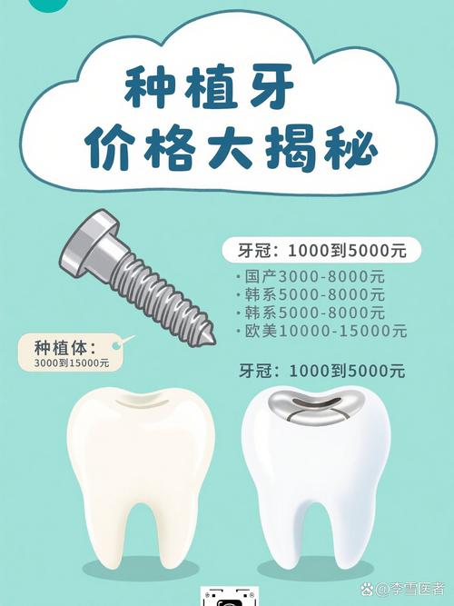 奥齿泰种牙使用寿命_奥齿泰种植戴牙步骤_奥齿泰种牙多少钱