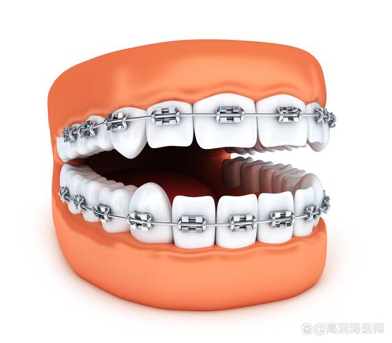 矫正牙齿多少岁合适_几岁做牙齿矫正合适_牙齿矫正合适的年龄