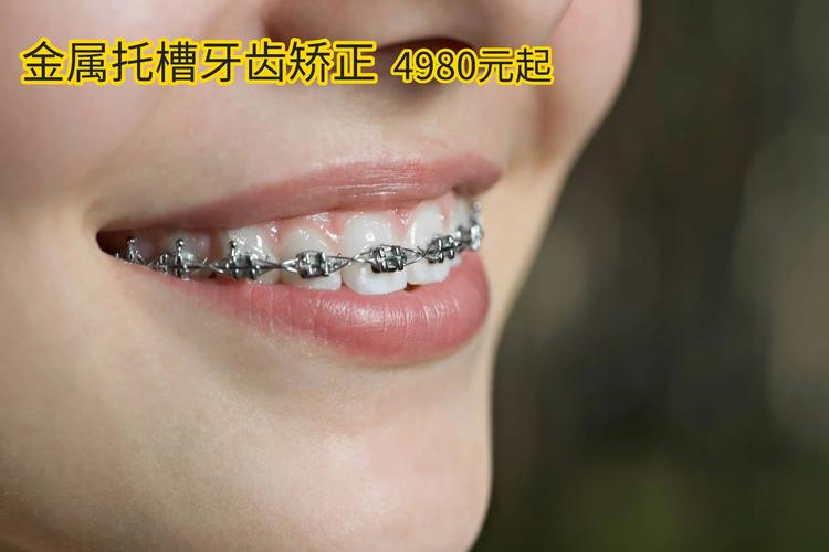 38岁可以牙齿矫正吗_牙齿矫正可以改变脸型吗_牙齿矫正可以只做上排牙吗