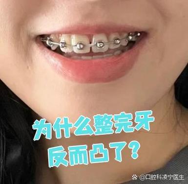 纠正牙齿的较佳年龄_纠正牙多少岁之前纠正合适_牙齿纠正的年龄限制
