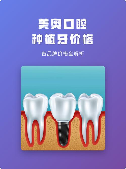 种植牙怎么选品牌_种植牙牌子有什么不同吗_全口种植牙选什么牌子的好