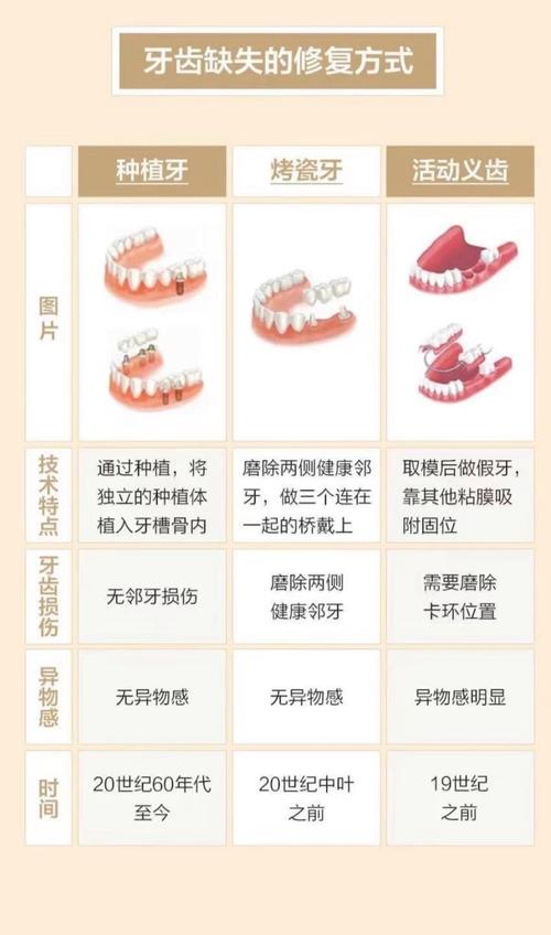 种植烤瓷牙多少钱一颗_按烤瓷牙还是种植牙_种植烤瓷牙好不好