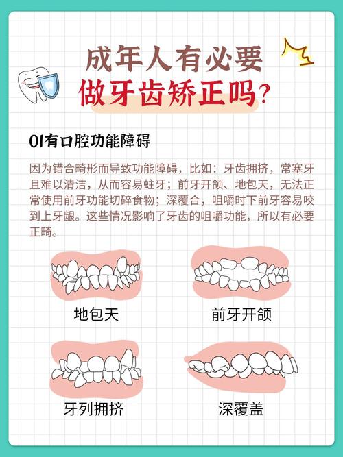 23岁做牙齿矫正来得及吗_一般做牙齿矫正得花多少钱_牙齿矫正麻烦吗