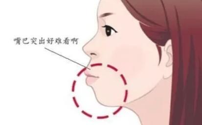 牙齿矫正颌垫的图片_矫正牙齿正颌_牙齿矫正颌垫的作用