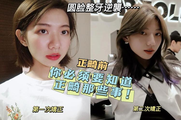 23岁整牙还来得及吗？过来人说实话