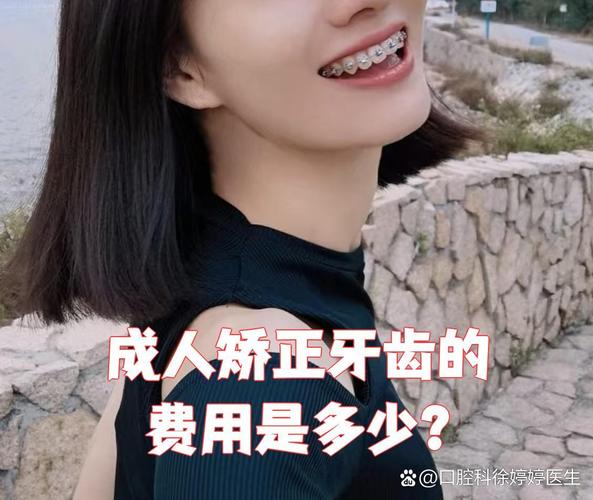 隐形牙齿矫正大概需要多少钱_矫正牙齿隐形矫正_矫正隐形牙齿过程