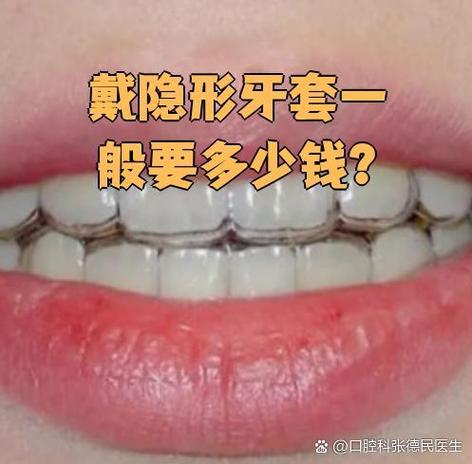 隐形牙齿矫正大概需要多少钱_矫正牙齿隐形矫正_矫正隐形牙齿过程