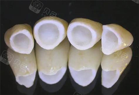 瓷牙深圳价格多少_深圳全瓷牙价格_瓷牙深圳价格查询