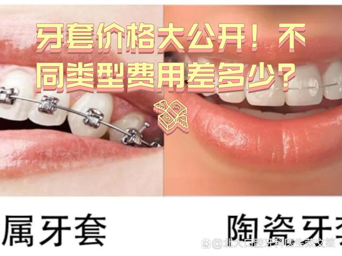深圳福田青少年钢丝正畸费用_苏州牙齿正畸费用_北京口腔医院正畸费用