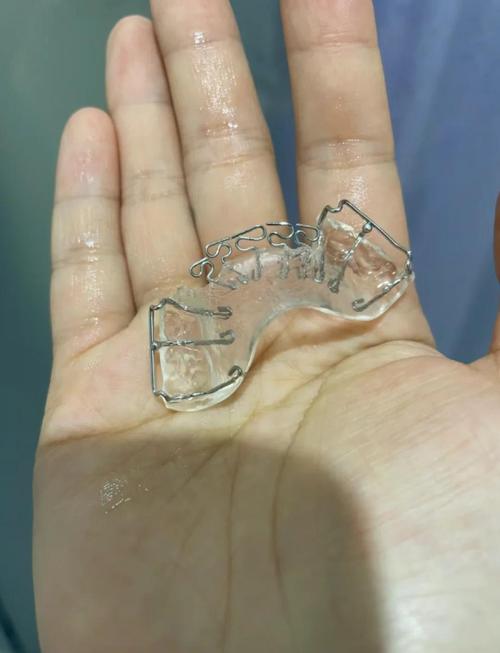 保定地包天牙齿矫正价格_保定牙齿矫正价格多少钱_牙齿矫正保定哪家医院好