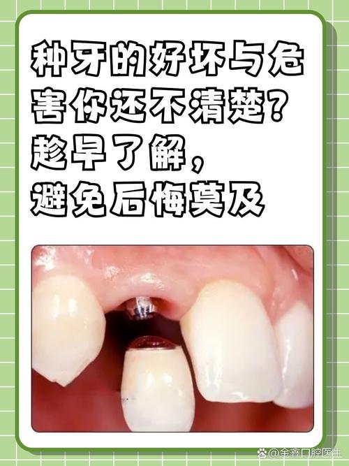 种植牙技术好_60岁的人种植牙好吗_种植牙齿好