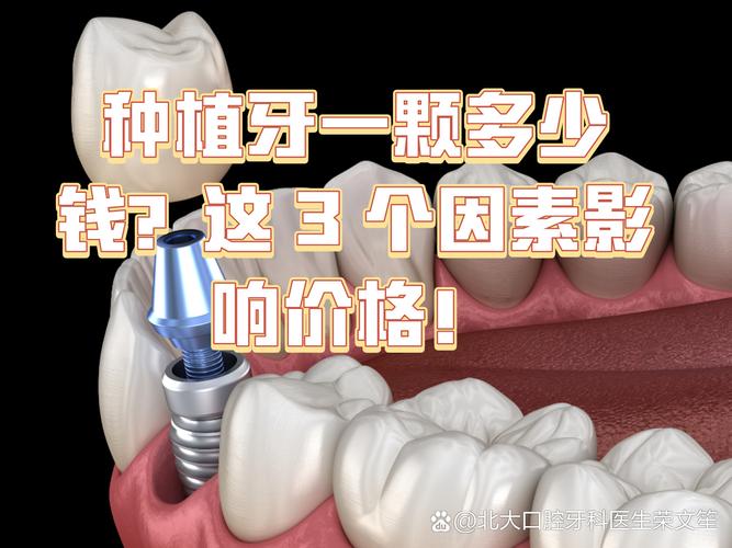 镶一颗种牙要多少钱_镶牙要种牙根吗_镶牙种牙费用