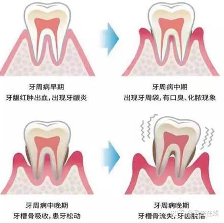 成人能进行牙齿矫正吗_成人牙齿矫正能进行几次_成人矫正牙齿可以吗