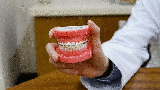 深圳隐形矫正多少钱_隐形矫正厂家_蛇口隐形矫正价格