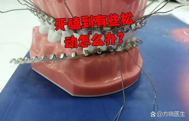 小孩牙磕松动固定有用_儿童牙齿磕碰松动_松动牙齿儿童磕碰图片