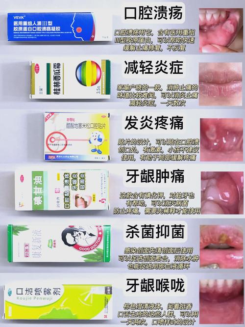 小孩口腔溃疡吃什么好的快?收下这份家庭偏方与饮食指南,轻松缓解娃的疼痛