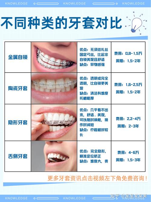 16岁整牙齿矫正多少钱_牙齿矫正大概要花费多少钱知乎_牙齿矫正你们花了多少钱