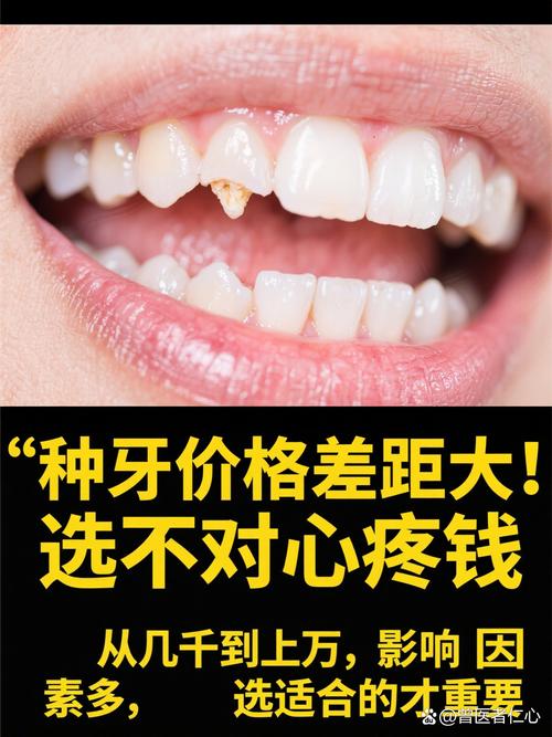 5年后种植牙爆发_牙齿种植之后还能矫正吗_种植牙发能维持几年