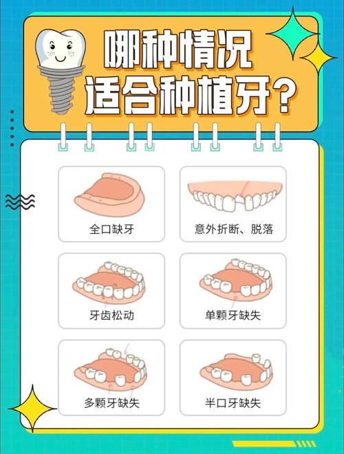 补牙和种牙区别在哪 哪个更适合你