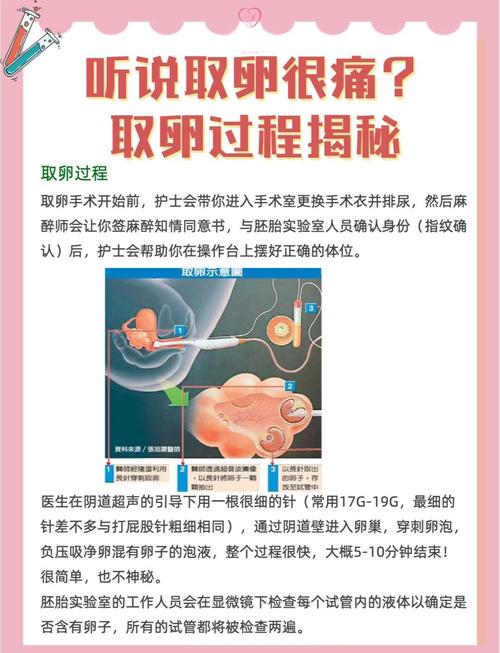 取卵流程_取卵操作_取卵操作流程