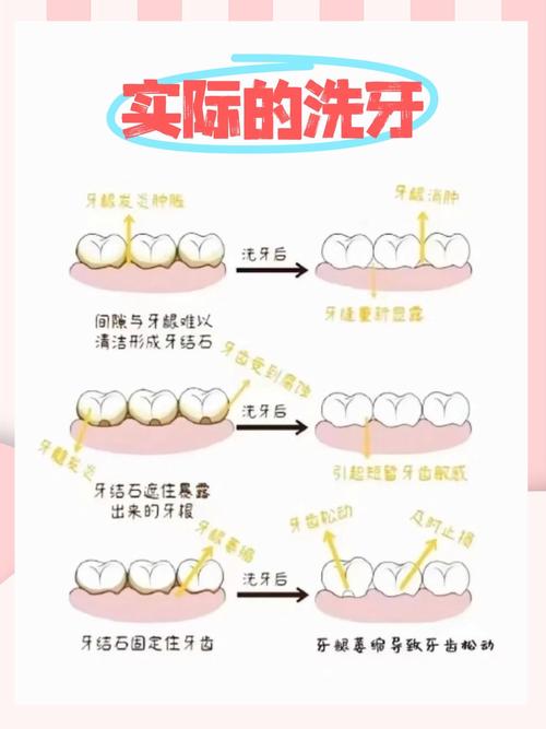 青盐洗牙_盐洗牙好吗_盐洗牙齿的正确方法