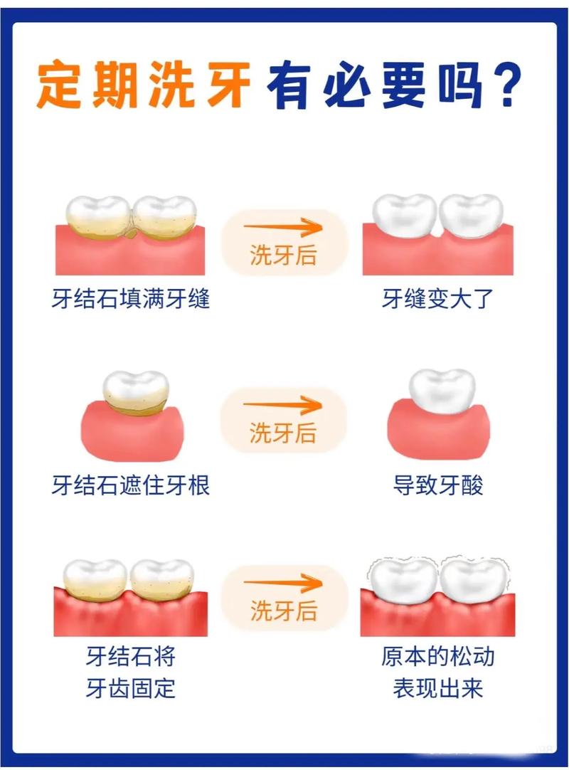盐洗牙好吗_青盐洗牙_盐洗牙齿的正确方法