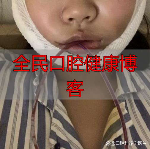 口腔颌面部受伤啥特点？不只影响呼吸进食，感染风险也很高