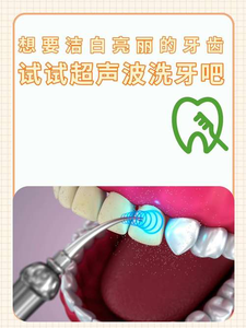 自己用超声波洗牙安全吗?洗牙是医疗行为,别自己瞎搞