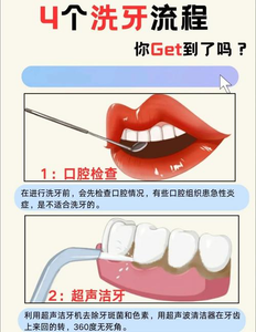 超声波自己洗牙安全吗_声波洗牙和超声波洗牙的区别_声波洗牙器有用吗