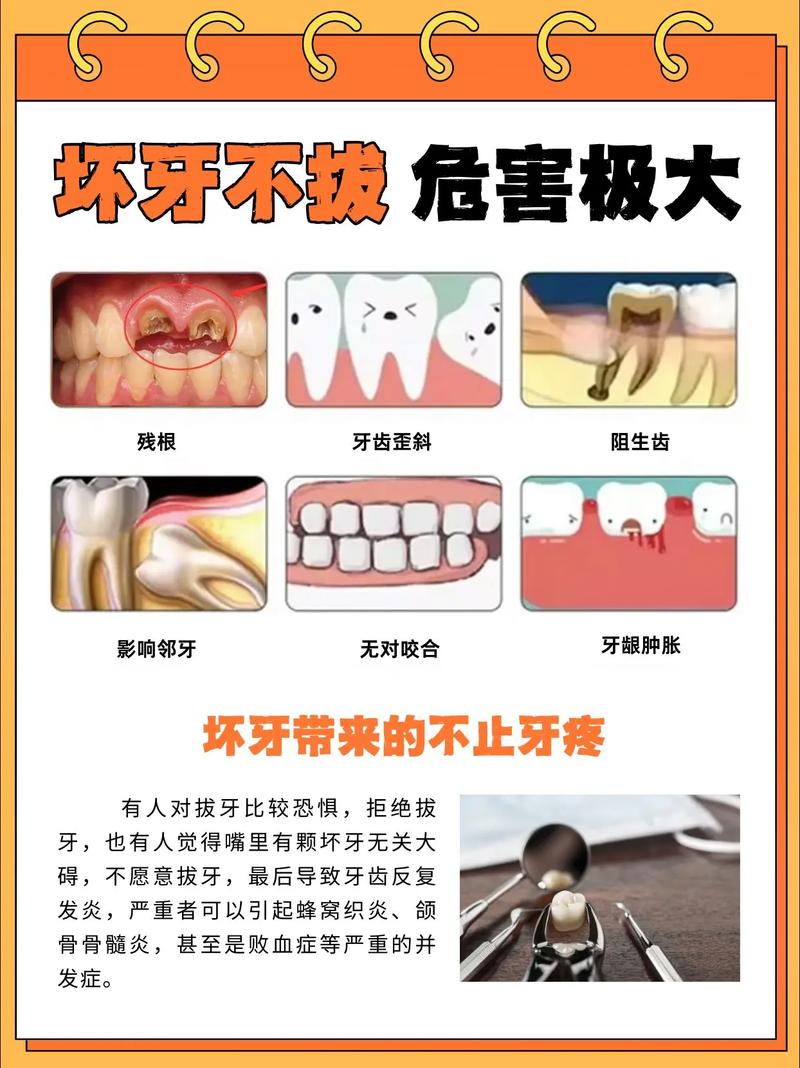 成人拔牙整牙的后遗症_成人牙拔牙种是要后补牙吗_成人拔牙后是不是要种牙